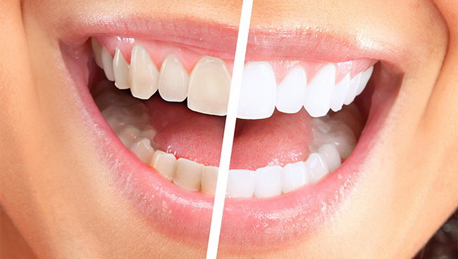 Dentist Montenegro Estetska stomatologija | Dentist Montenegro