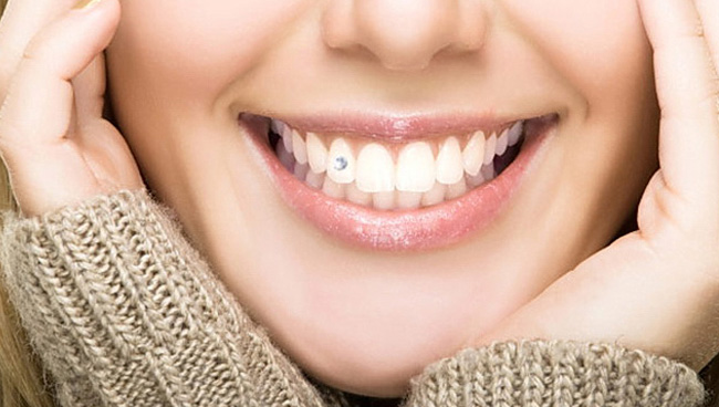 Dentist Montenegro Estetska stomatologija | Dentist Montenegro