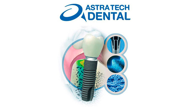 Dentist Montenegro Implantati