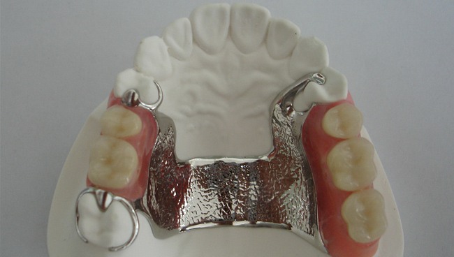 Dental studio Vučetić | Totalne i parcijalne proteze Dentist Montenegro
