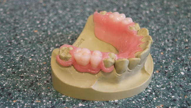 Dental studio Vučetić | Totalne i parcijalne proteze Dentist Montenegro