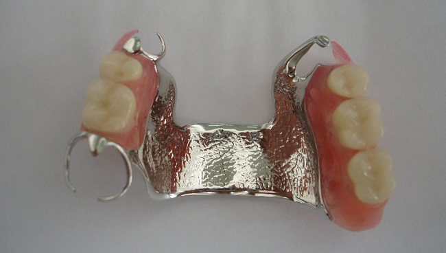 Dental studio Vučetić | Totalne i parcijalne proteze Dentist Montenegro